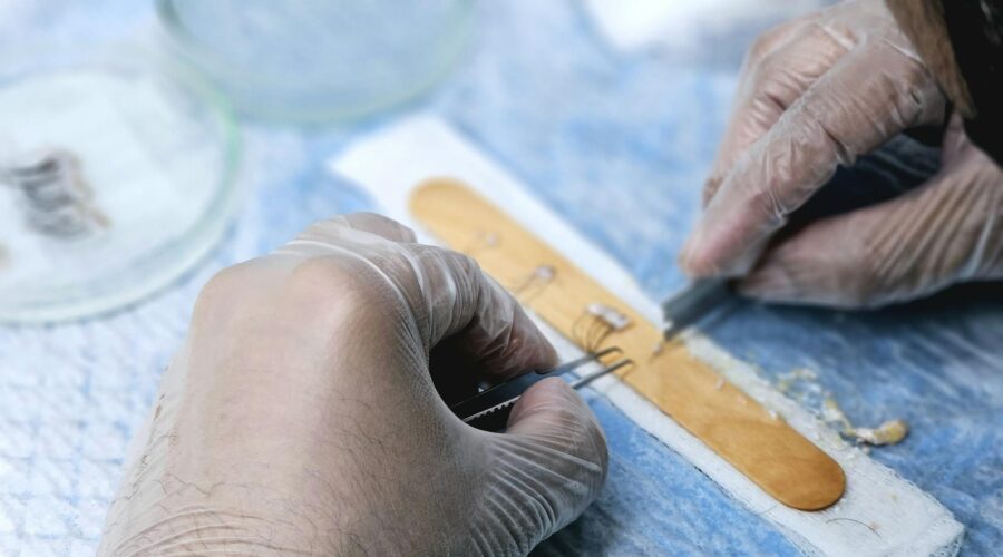 Historic First Kidney Transplant Performed in Cape Verde